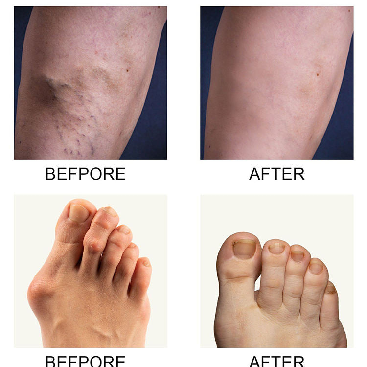 Perfectx Joint & Bone Therapy Cream (200g)